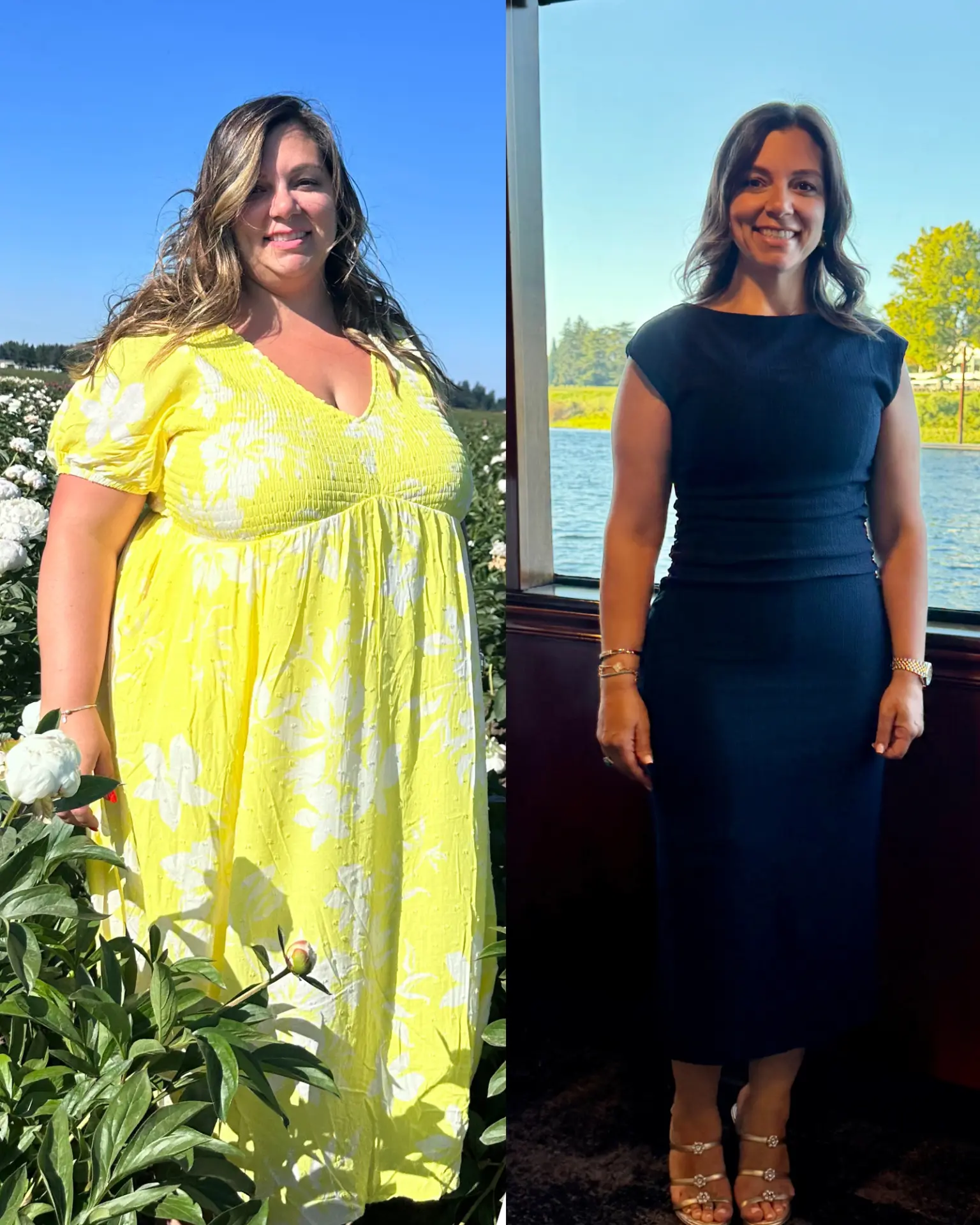 Real Elevé mommy makeover patient before and after — before on the left, after on the right